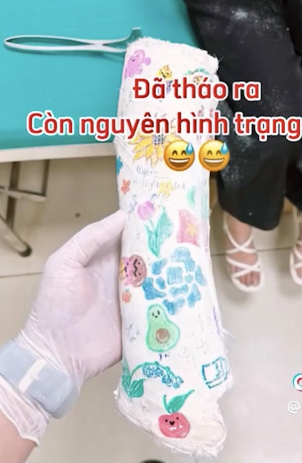 Vẽ lên bột trong lúc đang gãy tay, bé gái khiến bác sĩ không muốn tháo thành quả quá đẹp Ảnh 2