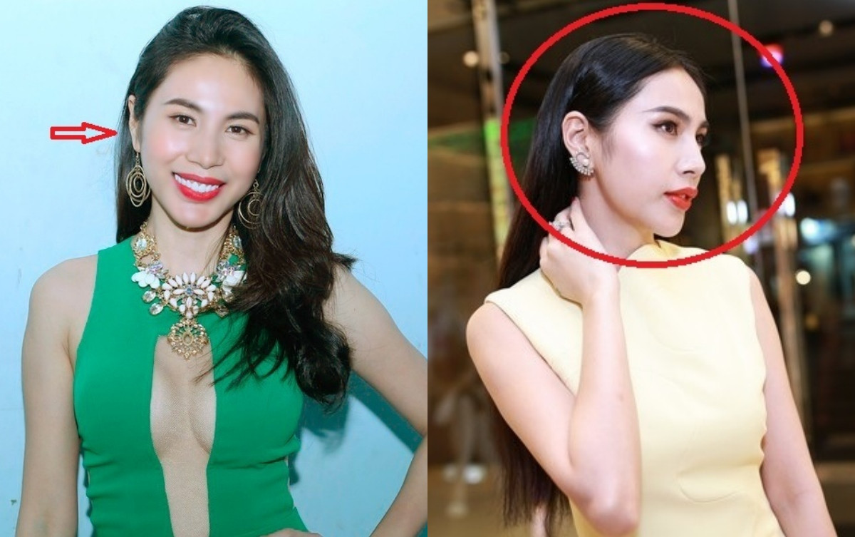 Thủy Tiên vẫn gặp sự cố thẩm mỹ dù được khen 'mỹ nhân dao kéo đẹp nhất' Ảnh 3