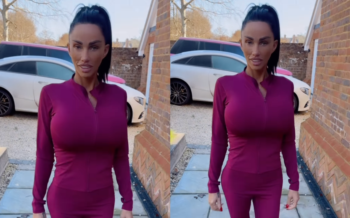 Phát hoảng trước diện mạo biến dạng của nữ người mẫu nghiện 'dao kéo' Ảnh 1