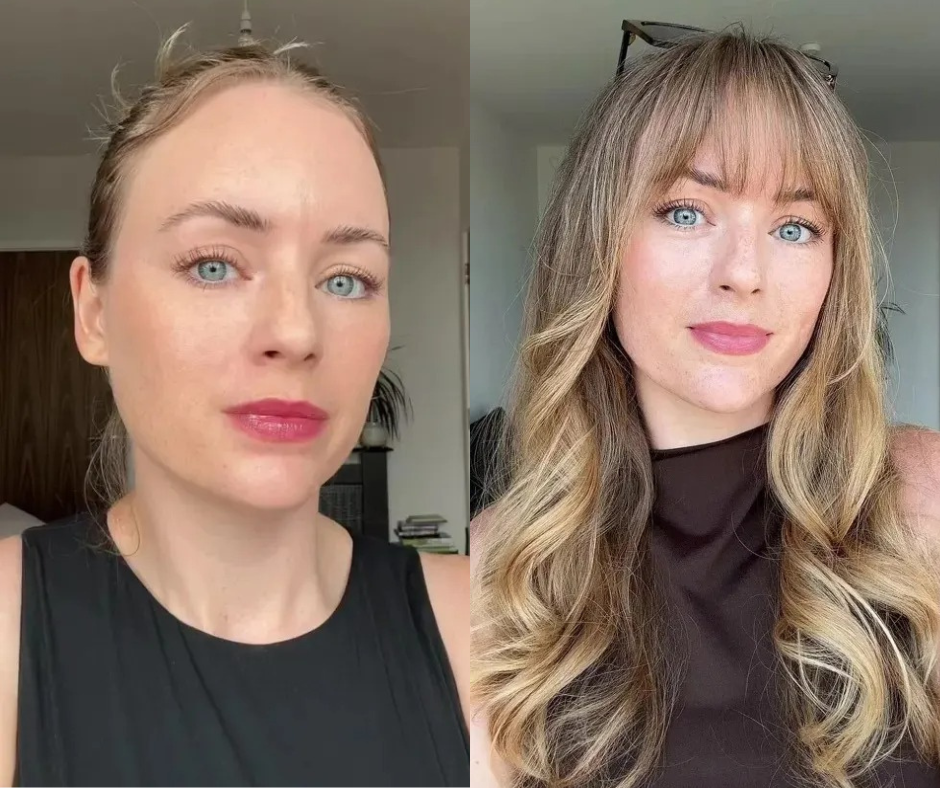 Bí quyết trẻ hóa diện mạo: Chỉ cần một thay đổi nhỏ mà không cần đến botox Ảnh 1