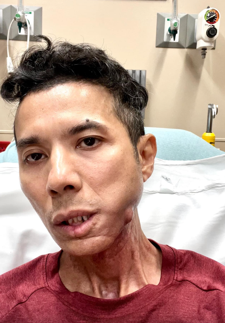 Kasim Hoàng Vũ gắng gượng điều hành nhà hàng sau khi xuất viện vì lo lắng không có tiền trang trải cuộc sống. Ảnh: FBNV