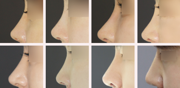 Vẻ đẹp chuẩn Hàn: Giải mã sức hút khiến giới trẻ Việt không thể cưỡng lại Ảnh 5