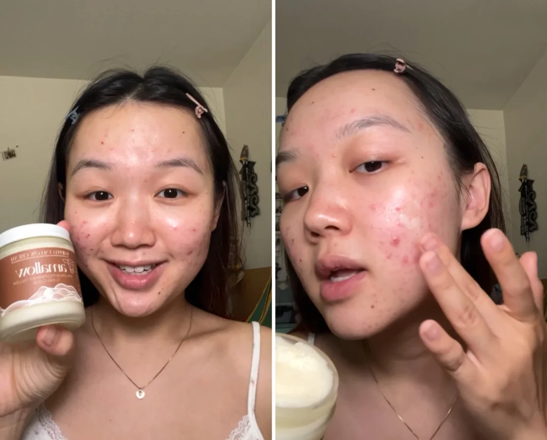 Grace May đã thử nghiệm với phương pháp đắp mặt nạ mỡ bò.