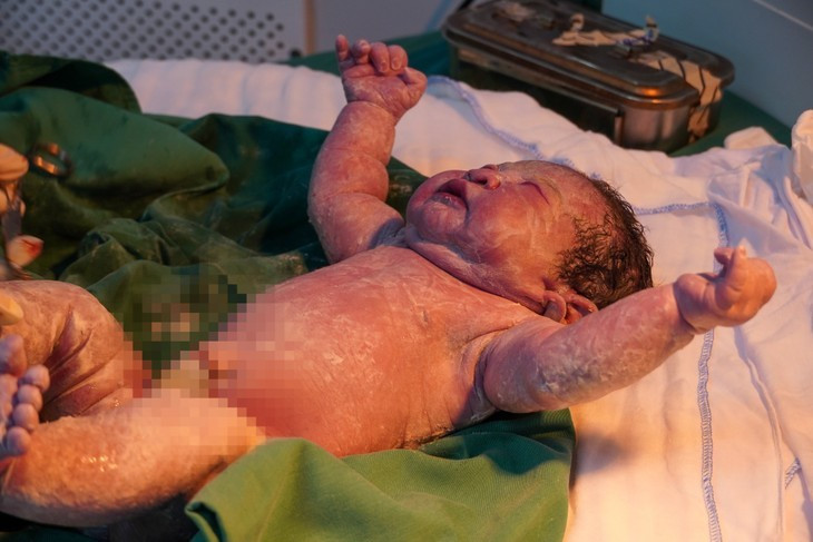Em bé cân nặng 4,1 kg đã ra đời khỏe mạnh