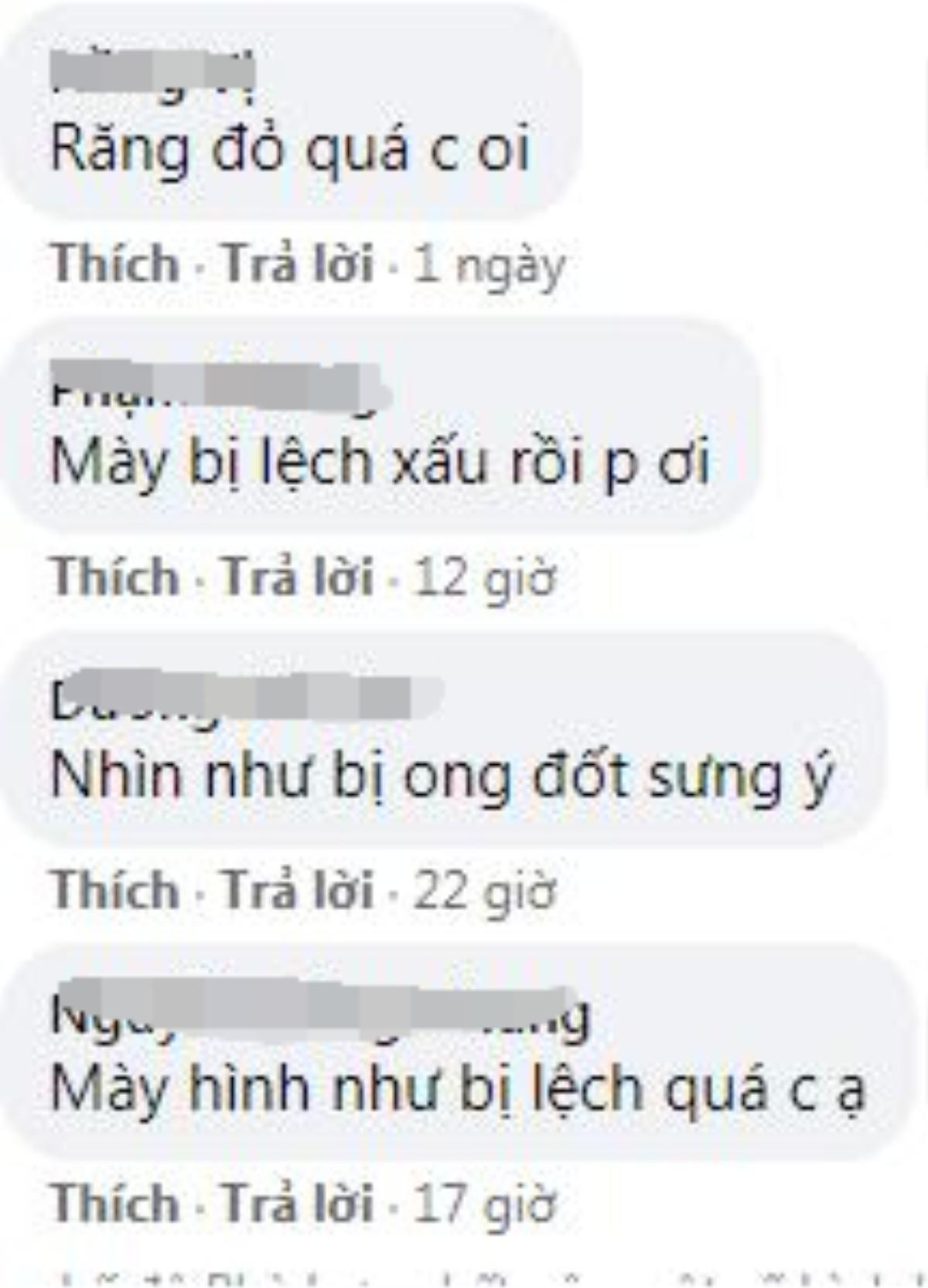 'Thị Nở' Quách Phượng tiếp tục 'trùng tu' nhan sắc nhưng nhận phản ứng ngược từ dân mạng Ảnh 5