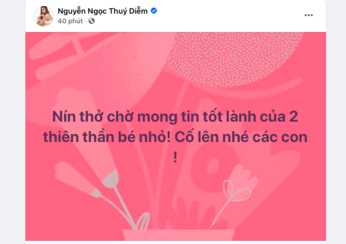 Mổ cặp song sinh dính liền phức tạp nhất Việt Nam: Sao Việt và cộng đồng mạng cùng nín thở cầu nguyện! Ảnh 1