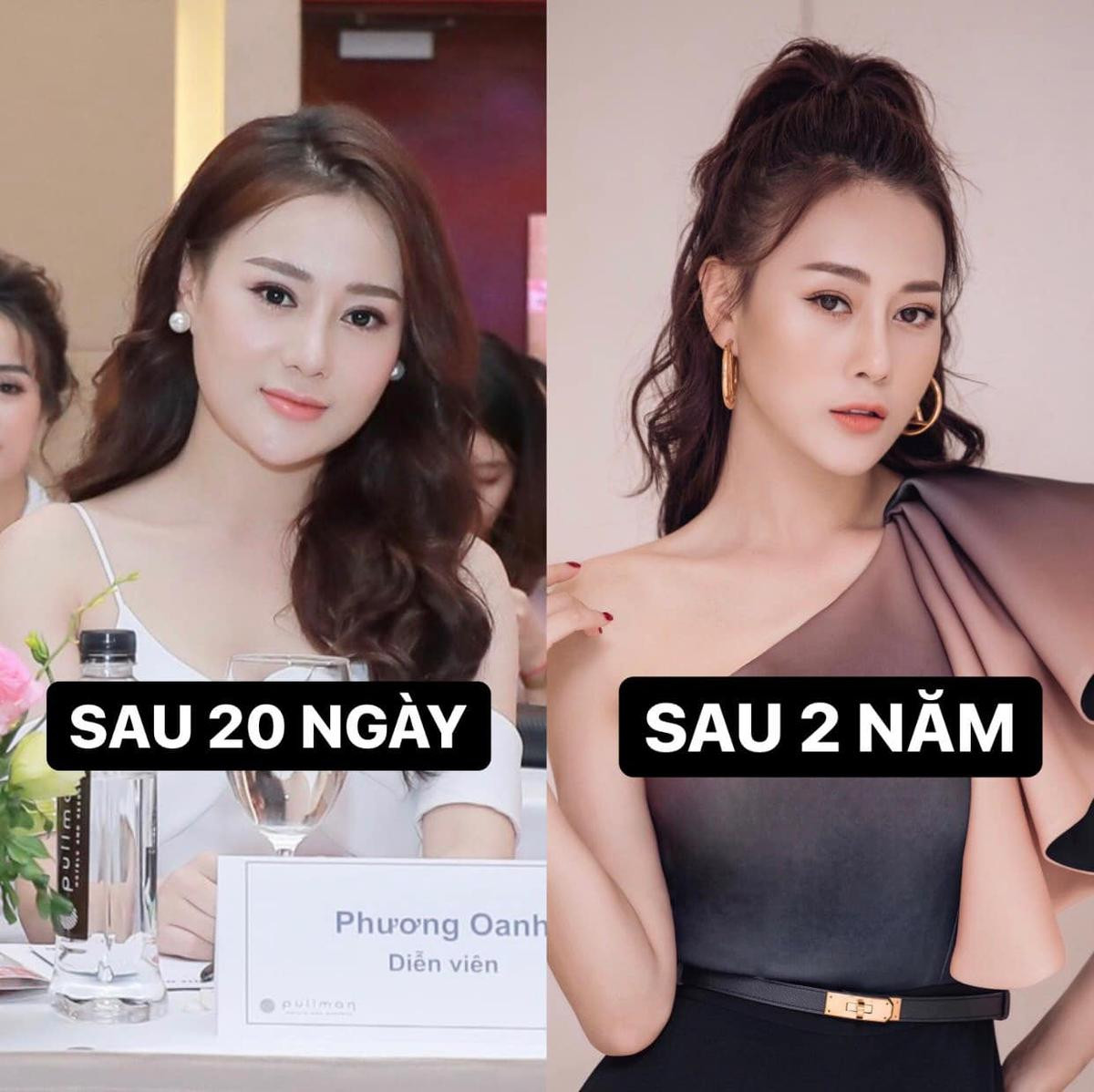 Phương Oanh tự so sánh hình ảnh nhan sắc thay đổi sau 7 năm nhờ phẫu thuật thẩm mỹ Ảnh 1