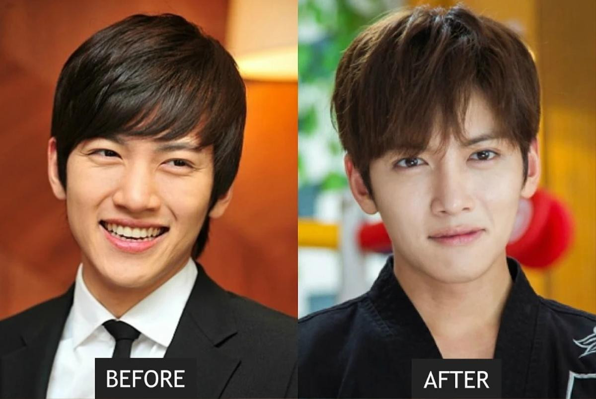 Netizen Hàn bối rối khi so sánh ảnh trước và sau phẫu thuật mũi của Ji Chang Wook Ảnh 1