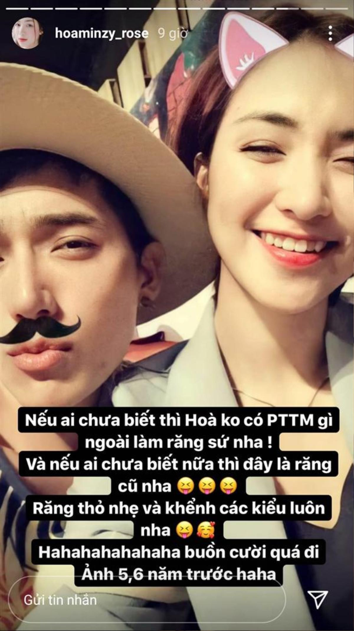 Hoà Minzy công khai chỉnh sửa bộ phận này trên khuôn mặt của mình Ảnh 1