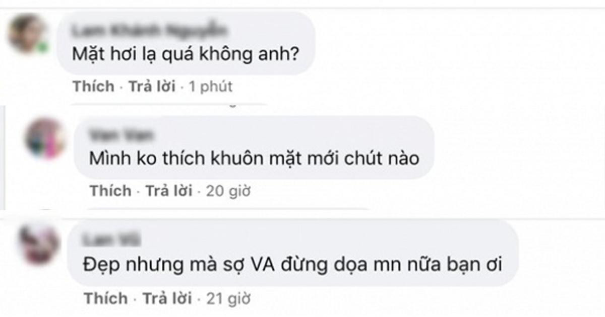 Gương mặt thẩm mỹ của Việt Anh bị anti-fan chê 'lạ hoắc, dọa người' Ảnh 2