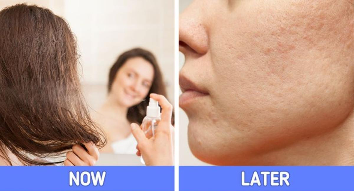 7 sai lầm skincare khiến mụn tới cản không kịp Ảnh 5