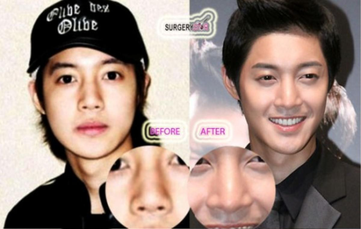 4 sao nam Hàn Quốc phẫu thuật thẩm mỹ: Có cả Ji Chang Wook và Kim Hyun Joong? Ảnh 12