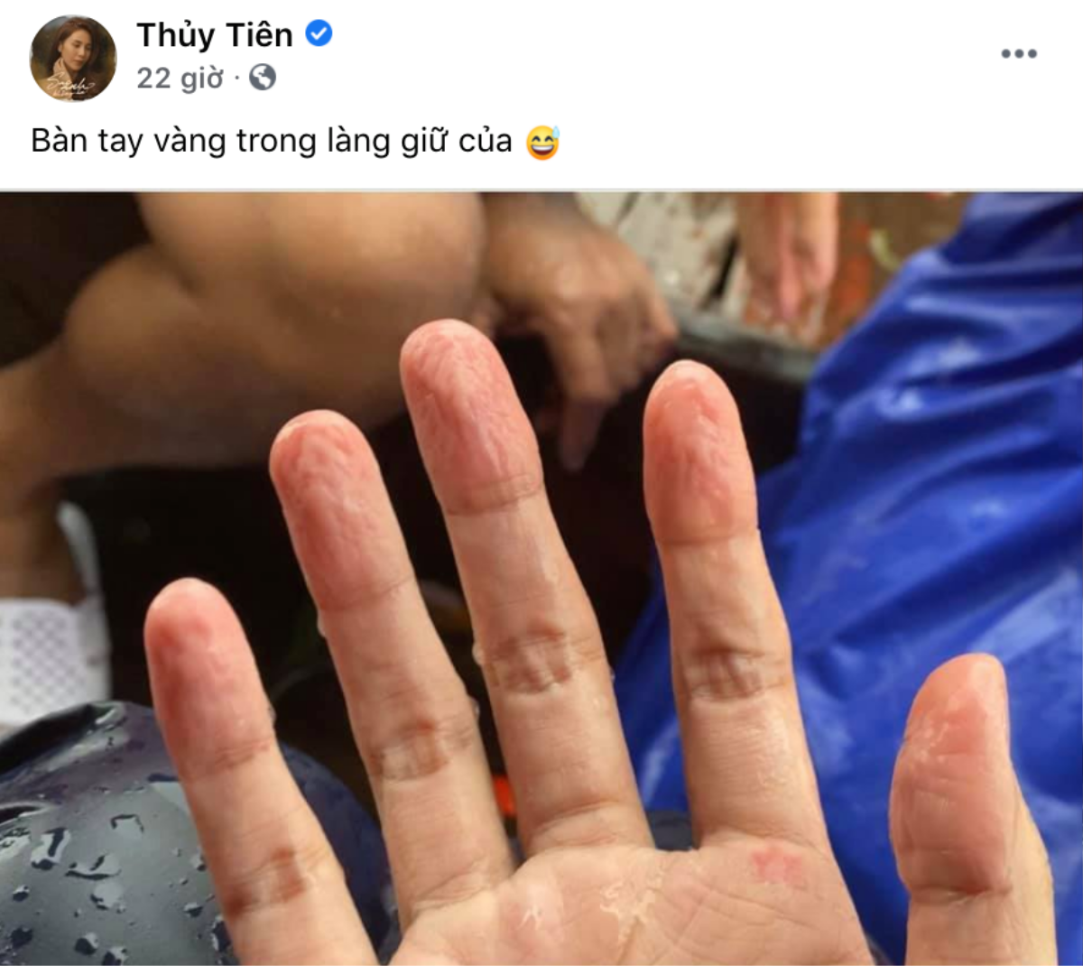 Thủy Tiên bị nổi ghẻ sau 1 tuần lặn lội trong nước lũ ở miền Trung: 'Ghẻ rồi, ngứa mà không dám gãi' Ảnh 2