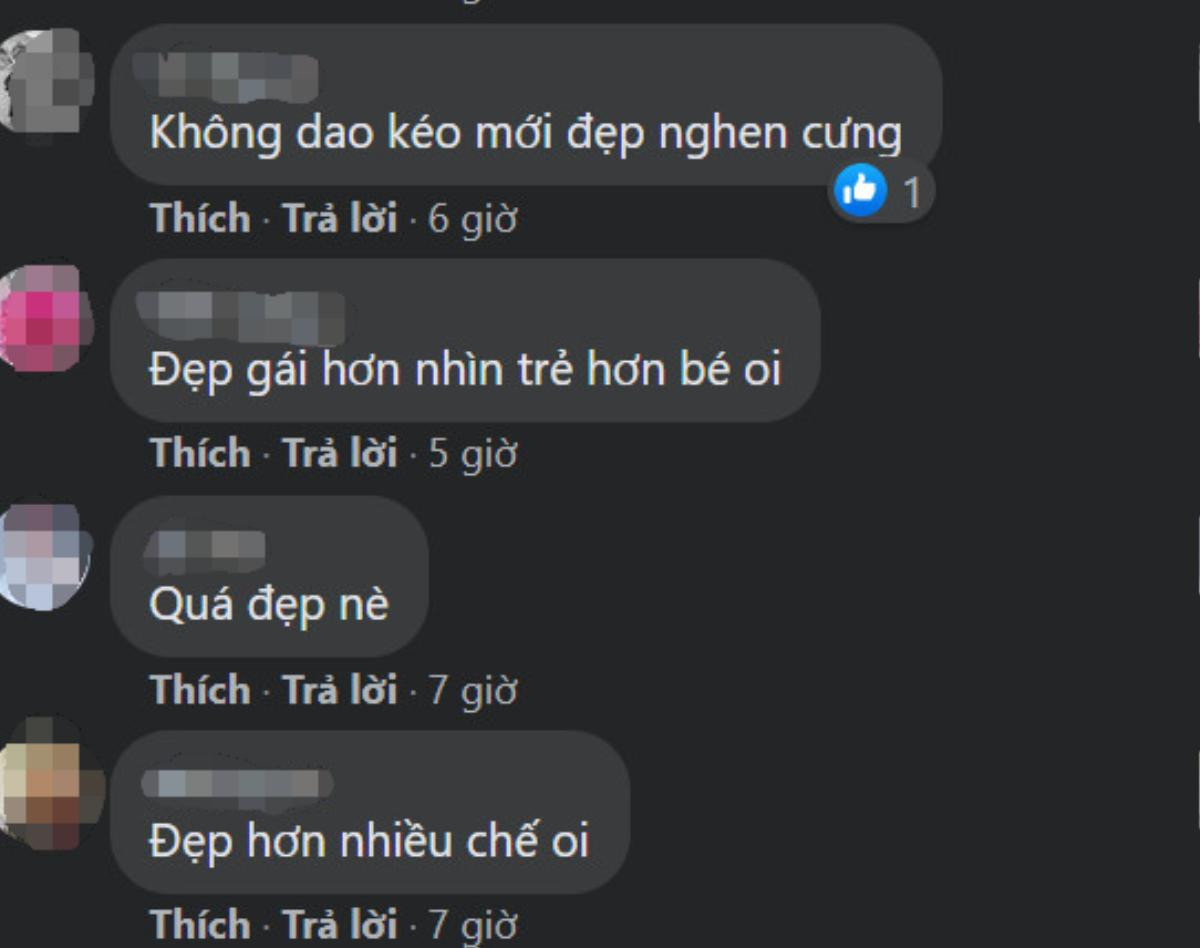 Ngân 98 tự tin khoe mặt mộc lại bị nói mát: 'Không dao kéo mới đẹp nghen cưng' Ảnh 6