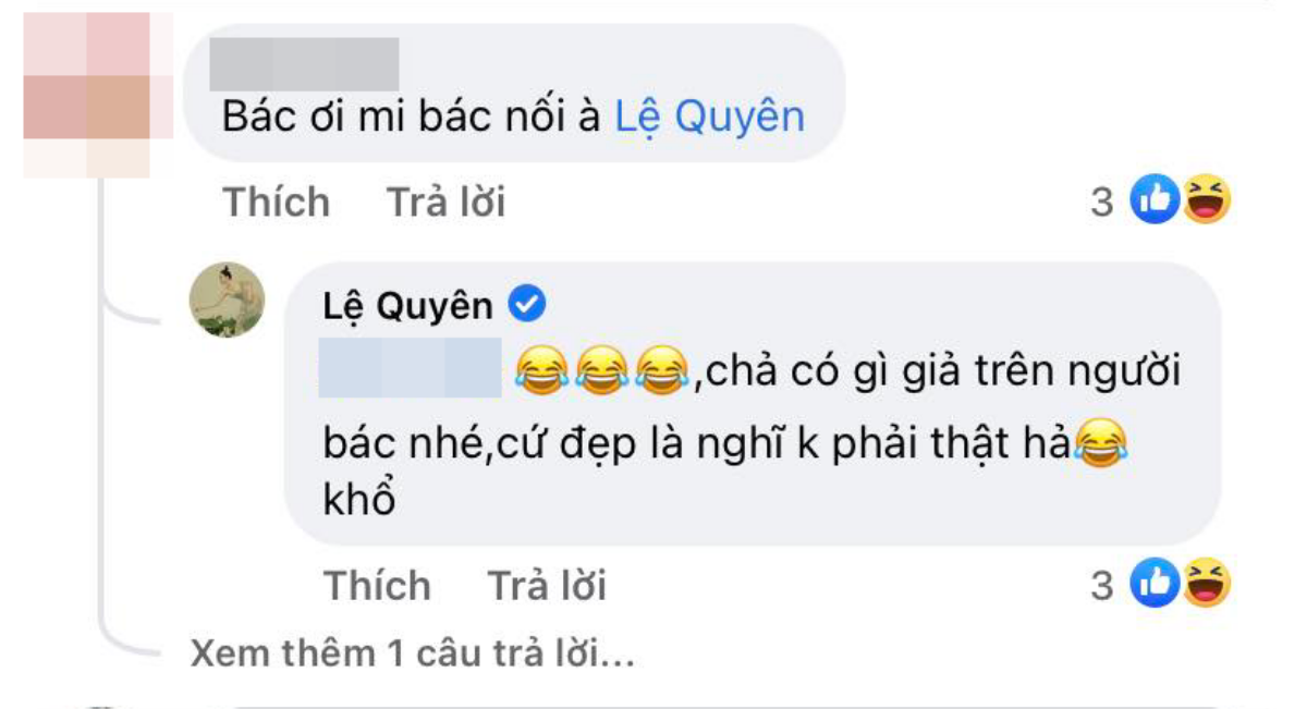 Bị chất vấn trùng tu nhan sắc, Lệ Quyên khẳng định: 'Chả có gì giả trên người nhé' Ảnh 2