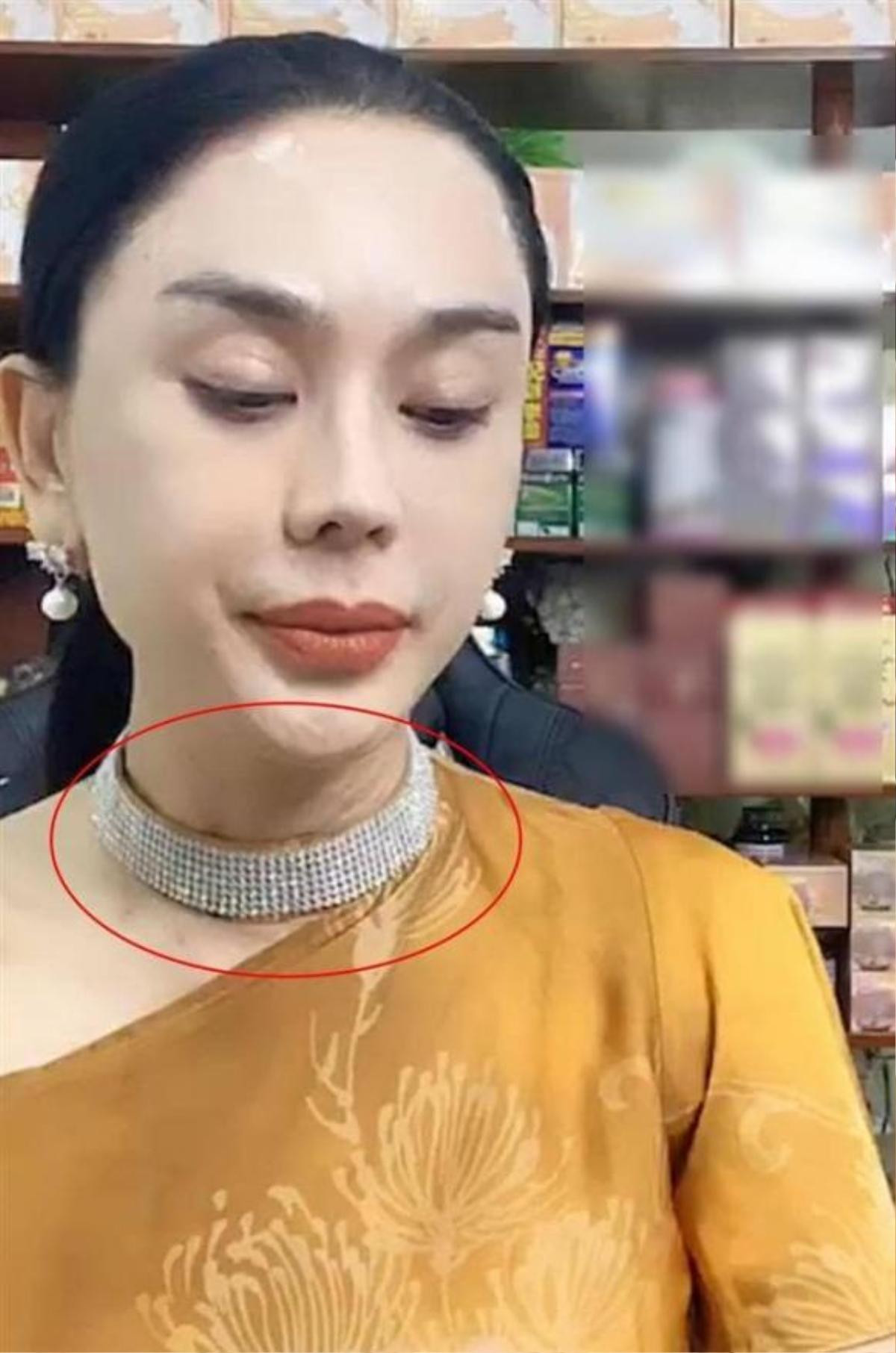 Lâm Khánh Chi lộ làn da cổ sần sùi nổi đầy hạt khi livestream Ảnh 2