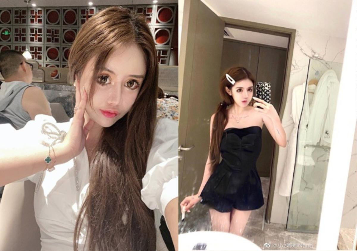 'Hotgirl thẩm mỹ' trải lòng chuyện dao kéo hơn 100 lần của bản thân khiến nhiều người bàng hoàng Ảnh 7