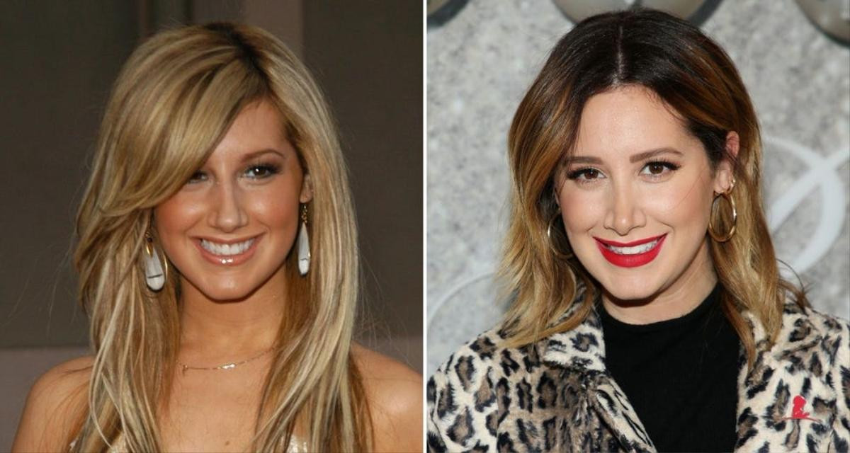 Ashley Tisdale khủng hoảng suốt 15 năm vì phẫu thuật nâng mũi Ảnh 3