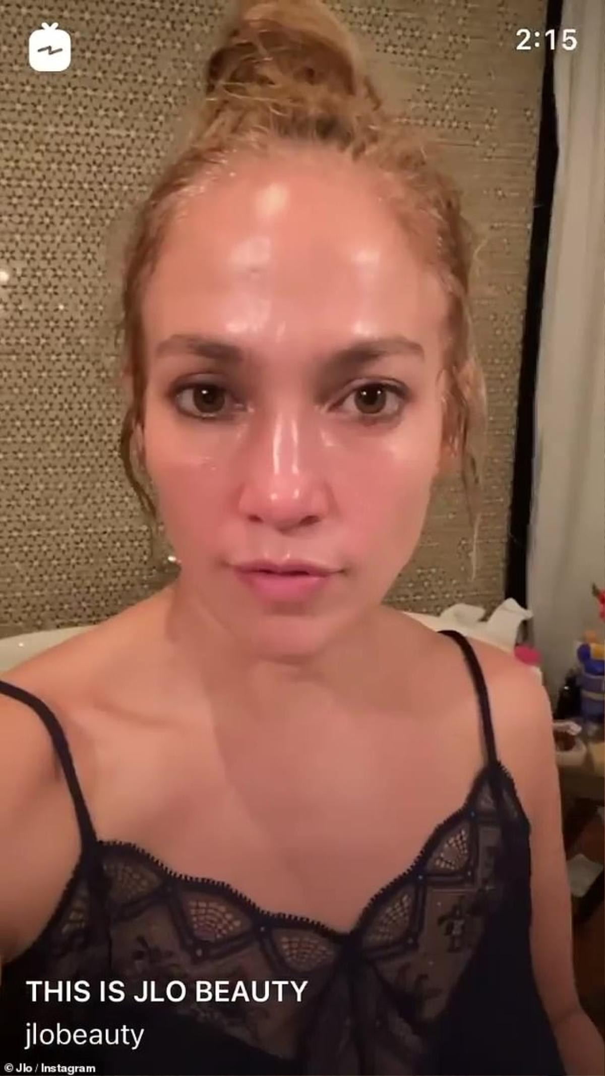 Jennifer Lopez nổi giận vì liên tục bị cáo buộc tiêm botox Ảnh 1