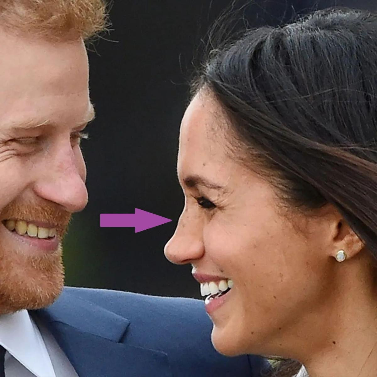 Meghan Markle lộ ảnh quá khứ khiến dân mạng đặt nghi vấn phẫu thuật thẩm mỹ vì chiếc mũi quá khác biệt Ảnh 5