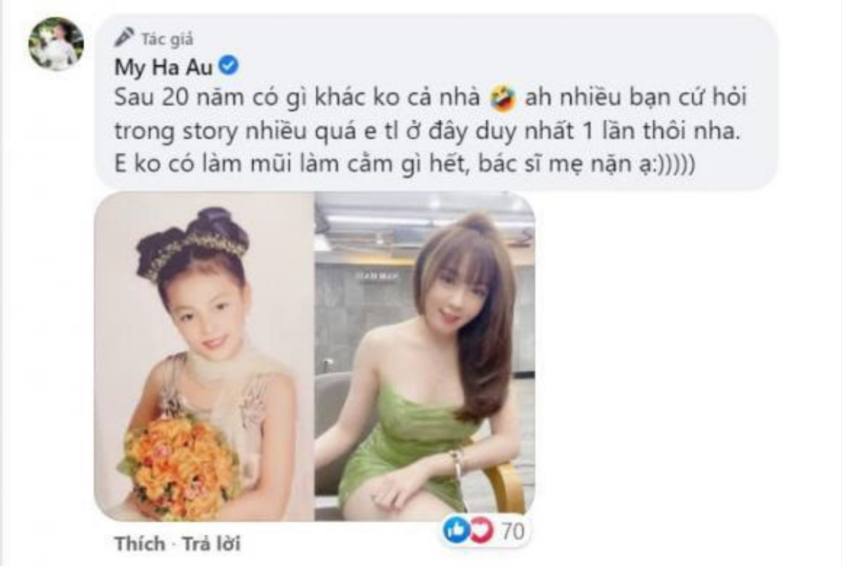 Lộ ảnh quá khứ khác xa hiện tại, netizen đặt nghi vấn Âu Hà My 'can thiệp dao kéo' Ảnh 7