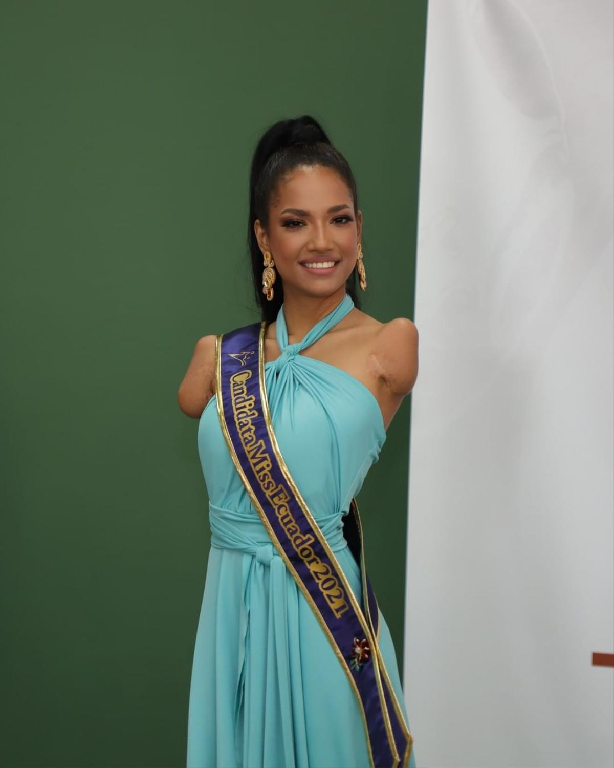 Mỹ nhân cụt 2 tay - 1 chân gây xúc động mãnh liệt tại Miss Ecuador 2021 Ảnh 1