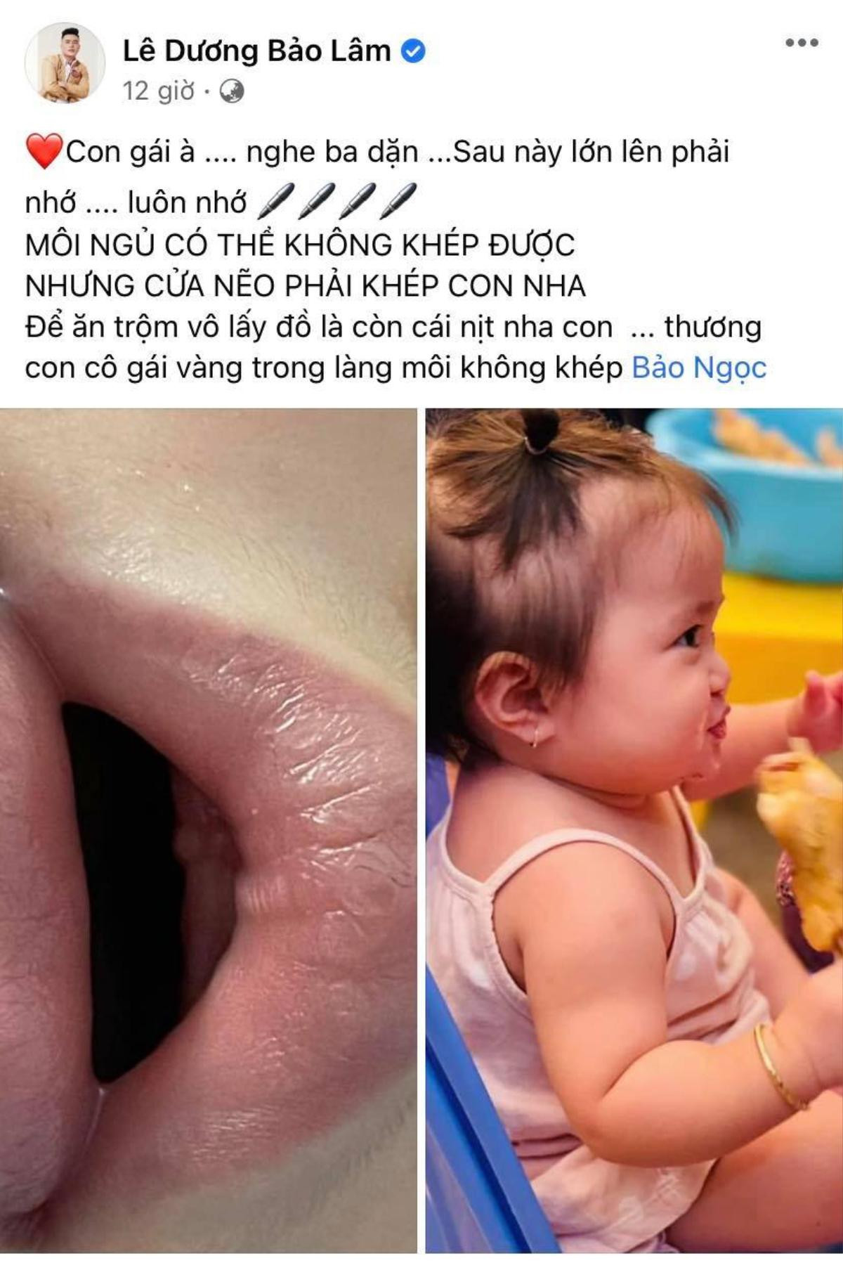 Lê Dương Bảo Lâm 'lo lắng' vì con gái út trở thành 'cô gái vàng trong làng môi không khép' Ảnh 1