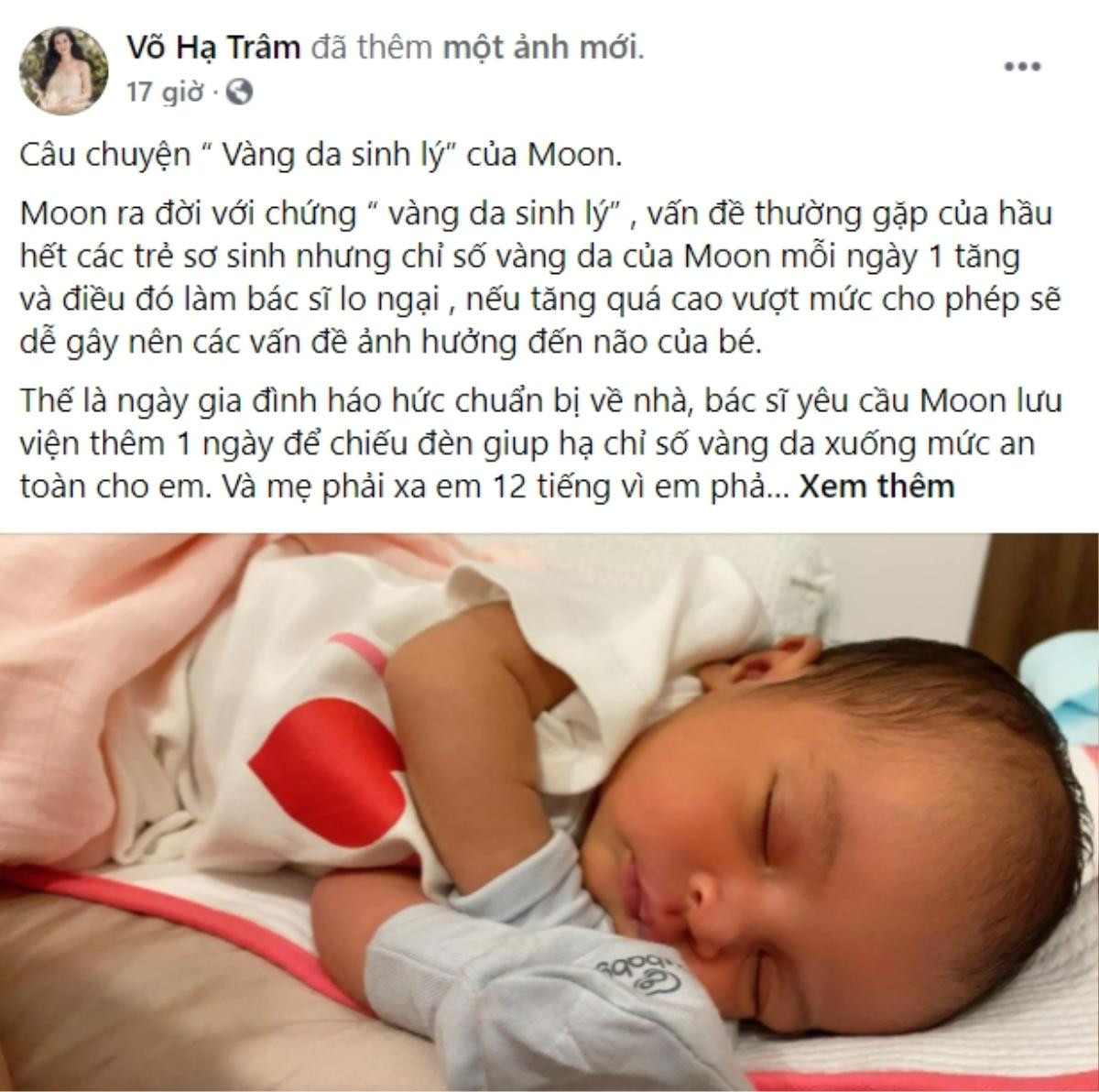 Con gái Võ Hạ Trâm mắc bệnh mà nhiều trẻ hay gặp, nguy hiểm cỡ nào mà khiến cô như 'ngồi trên lửa'? Ảnh 1