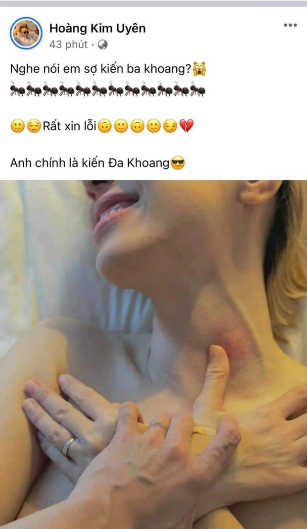 Xôn xao một nữ ca sĩ và bạn trai đăng ảnh 18+, bàn tay người nam chạm đúng 'điểm nhạy cảm' Ảnh 2