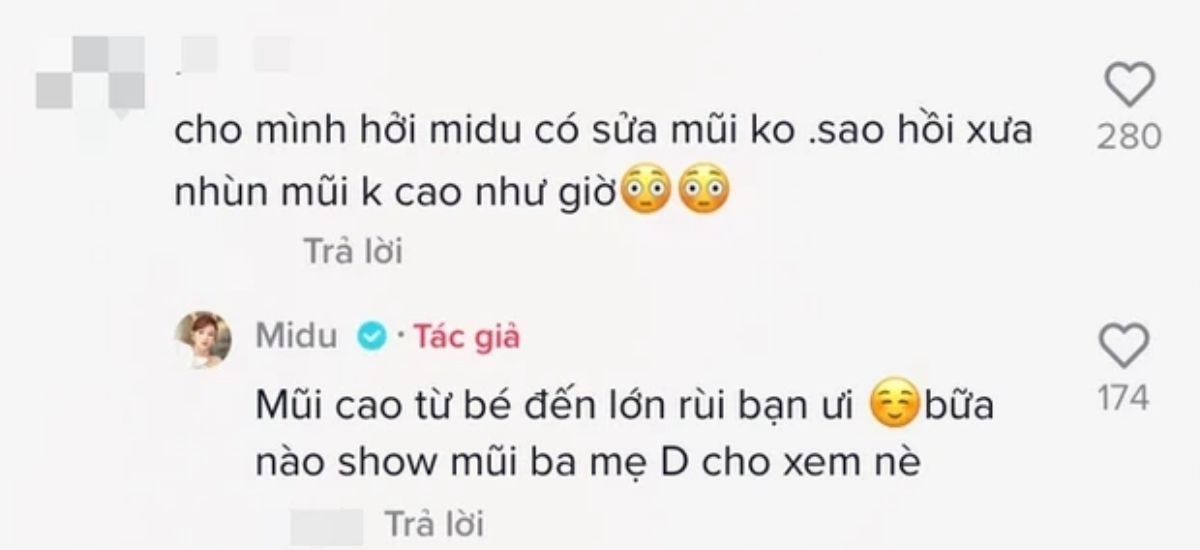 Những lần chứng minh không 'dao kéo' của Midu: Hết véo mũi tới đăng ảnh quá khứ vẫn bị soi Ảnh 4