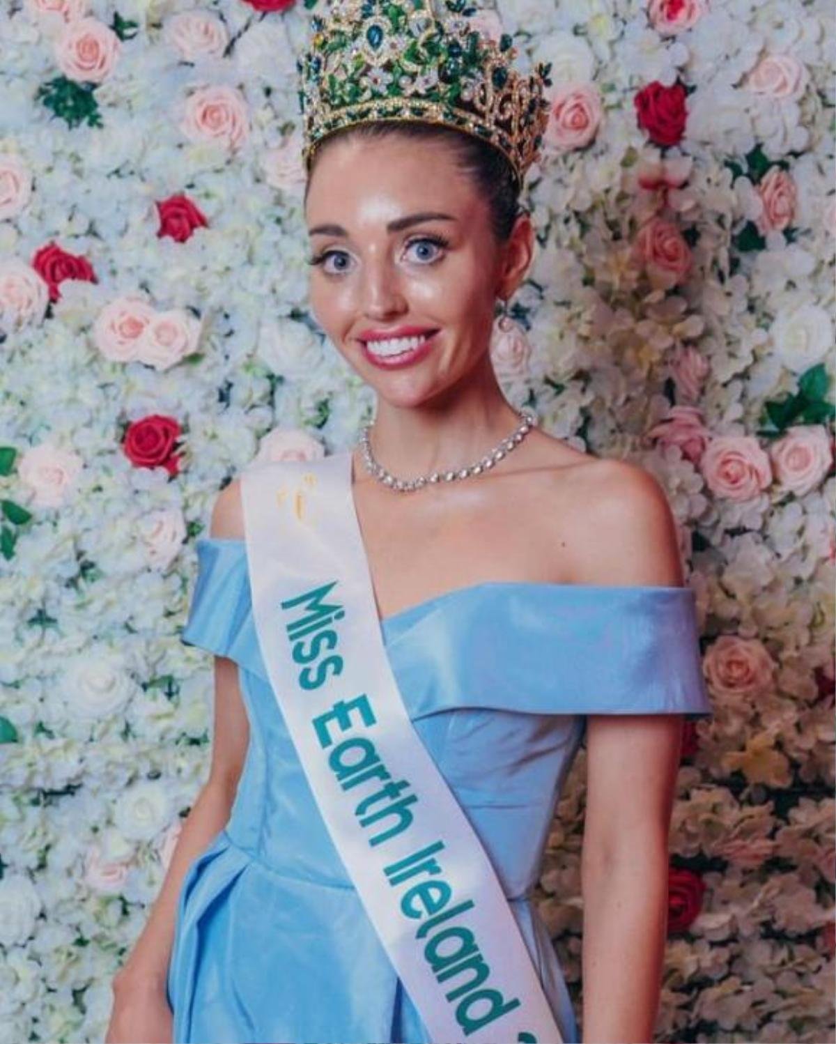 Vừa đăng quang, Tân Miss Earth Ireland 2021 bị chê như phẫu thuật phẩm mỹ bị lỗi Ảnh 1