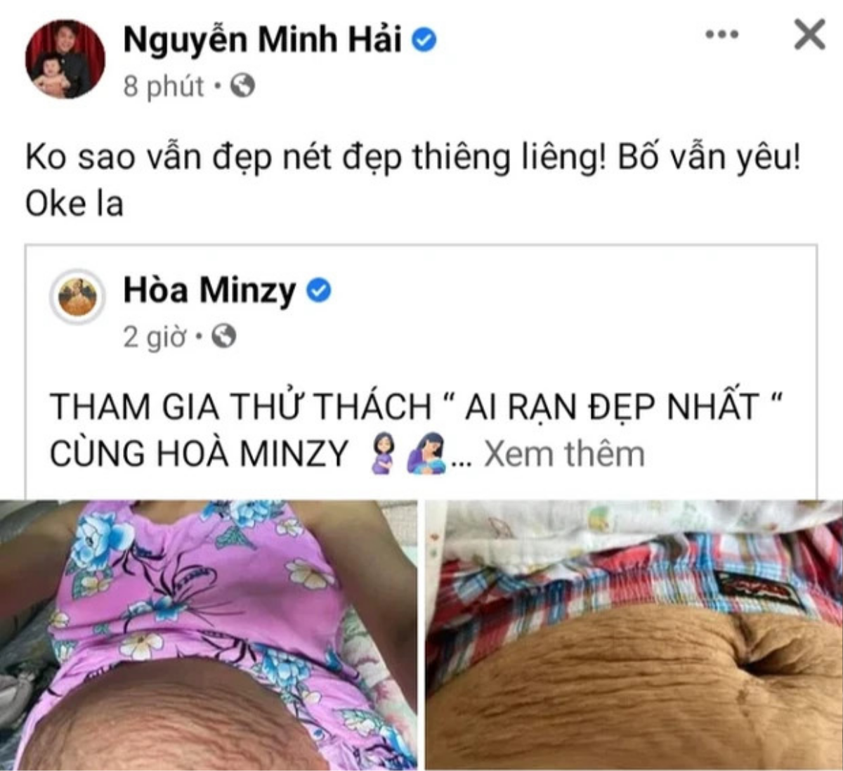 Phản ứng của ông xã Hòa Minzy khi vợ hé lộ vết rạn chằng chịt trên bụng khiến dân tình nức lòng Ảnh 1