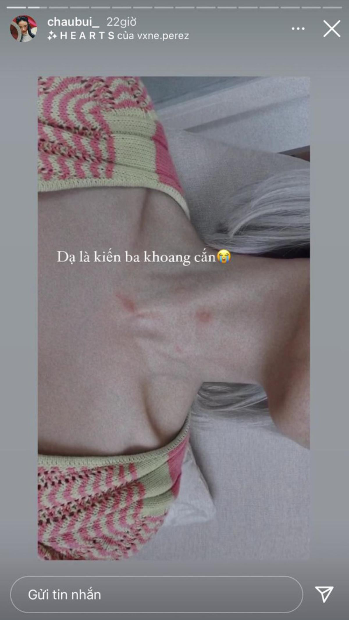 Lộ dấu lạ trên cổ, Binz bị hỏi hickey hay bị kiến cắn? Ảnh 2