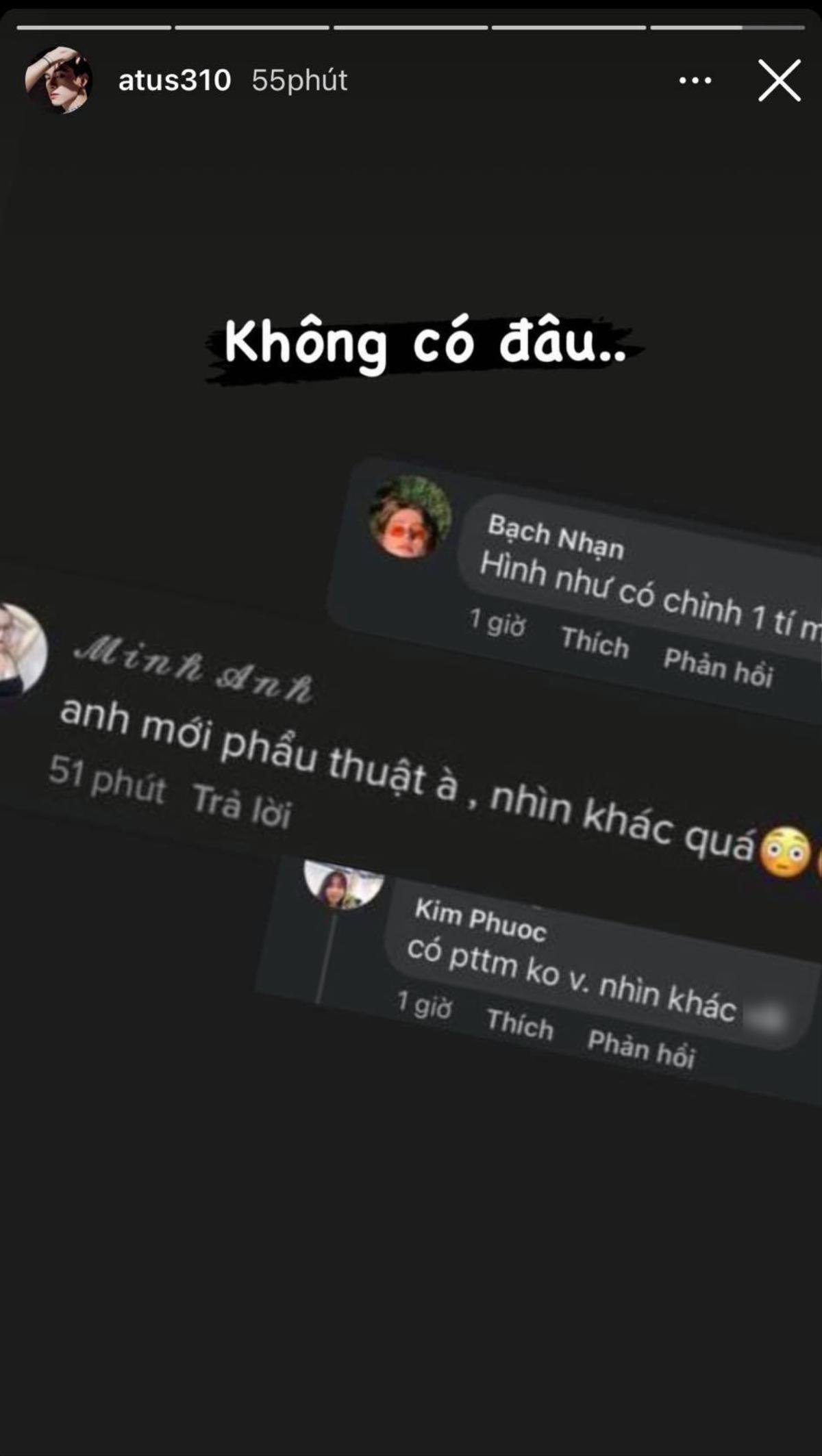 Anh Tú bị nghi 'dao kéo' vì khuôn mặt 'khang khác', liền phản ứng thế này! Ảnh 3