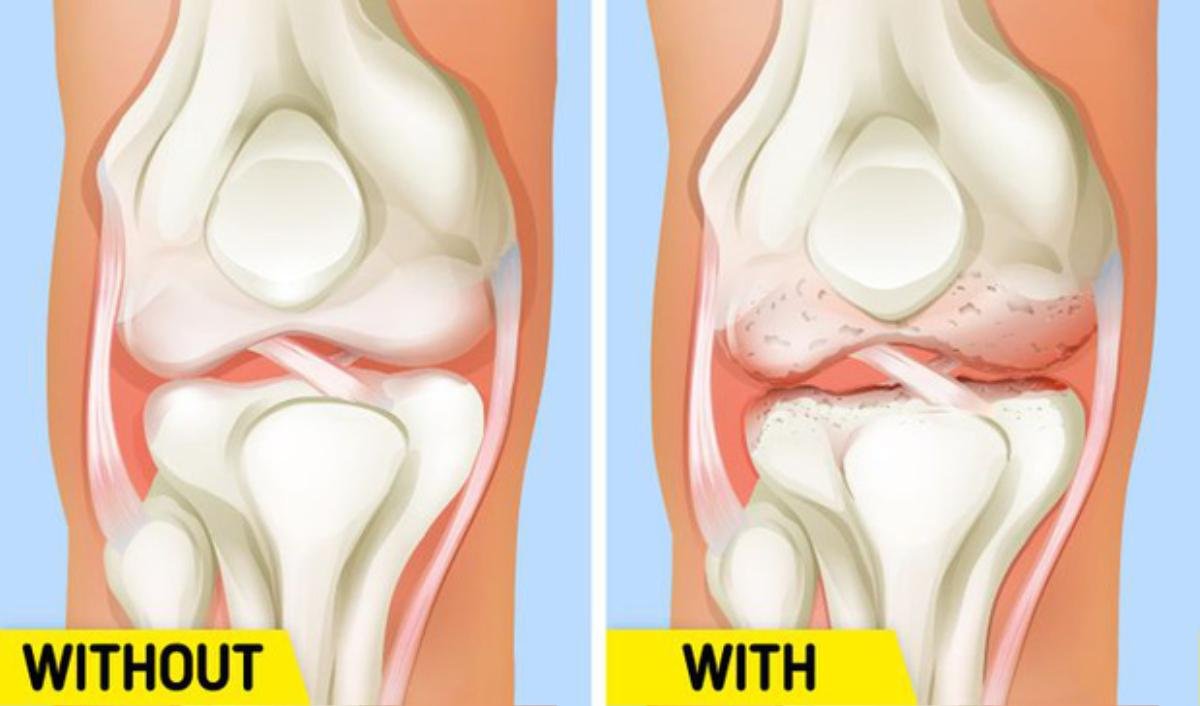 11 thói quen tưởng tốt nhưng hóa ra lại cực có hại: Điều số 2 gần như 99% mọi người đều mắc Ảnh 7