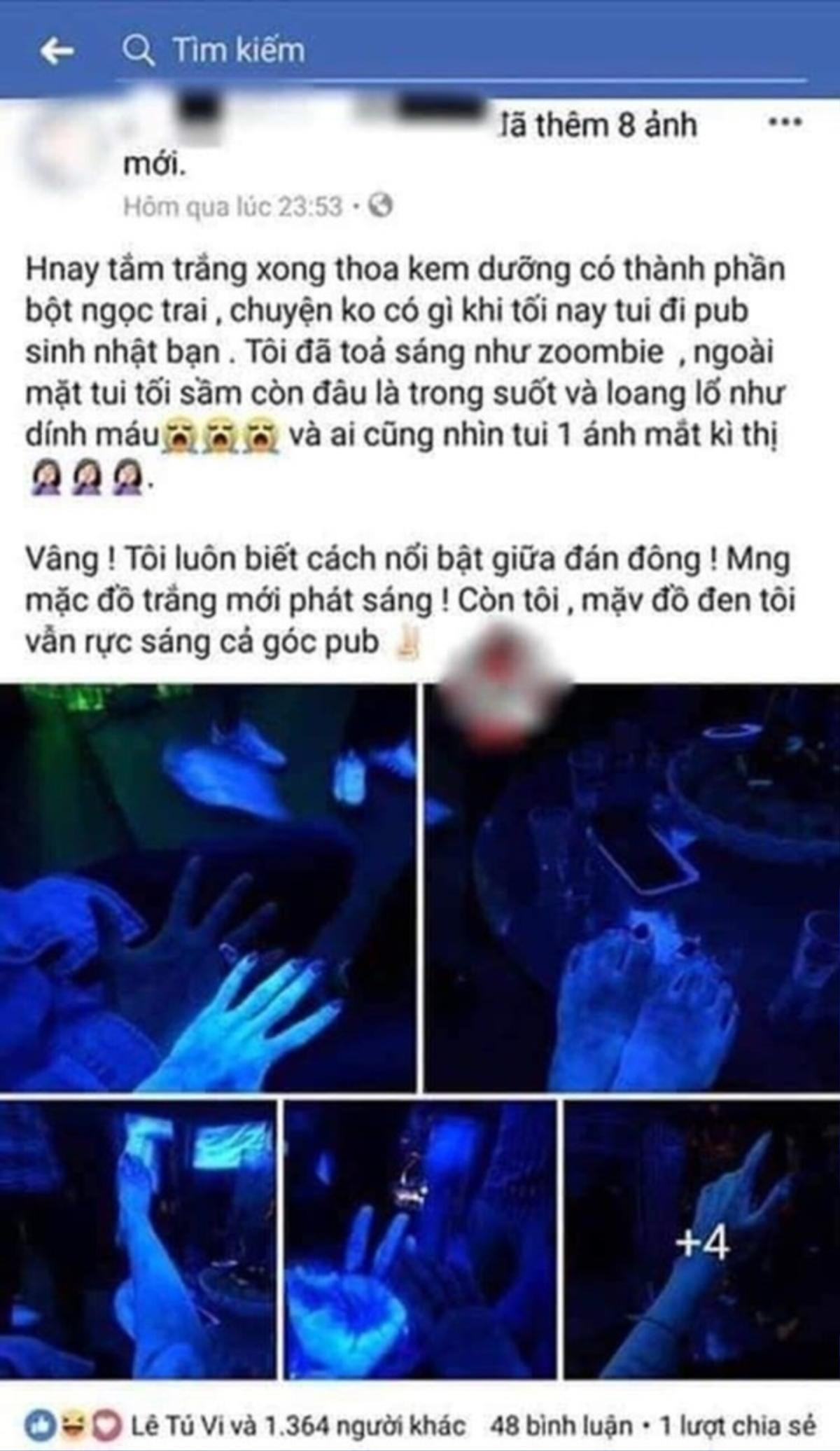 Đi pub cùng với hội bạn, tay chân cô gái bỗng phát sáng như zoombie, biết lý do ai nấy cũng sợ hãi Ảnh 3