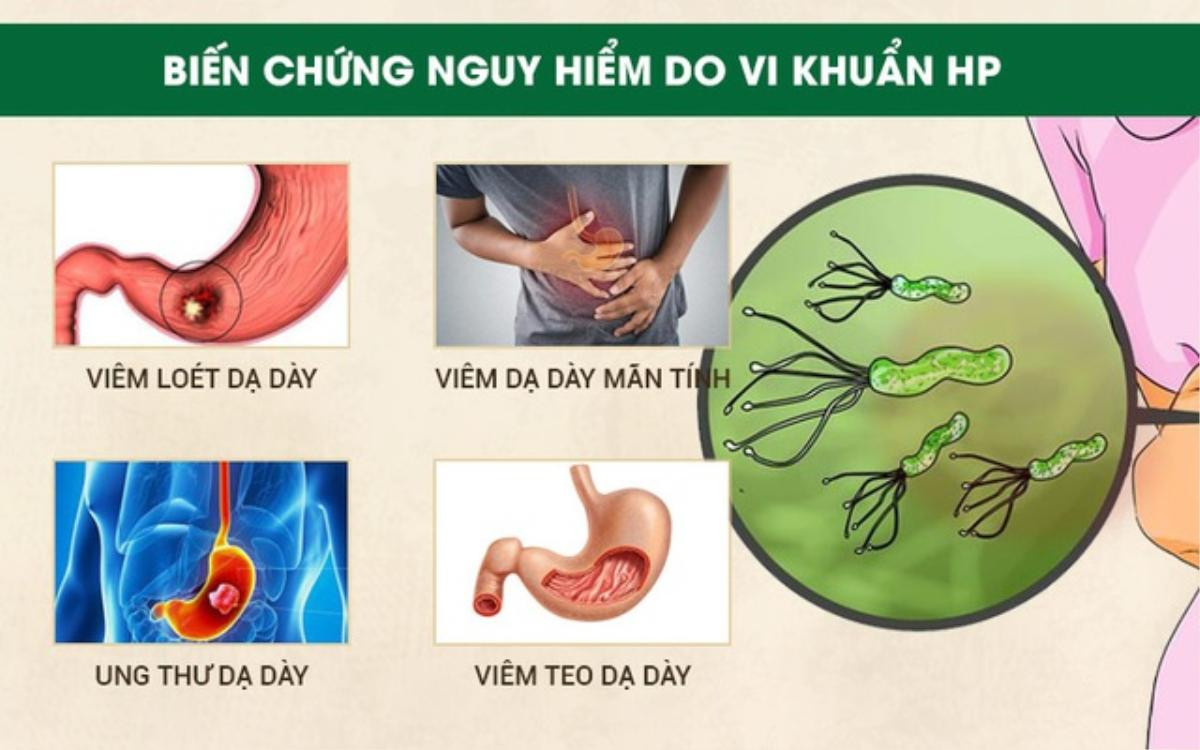 Những nhóm người nào có nguy cơ mắc ung thư dạ dày cao hơn? Ảnh 3