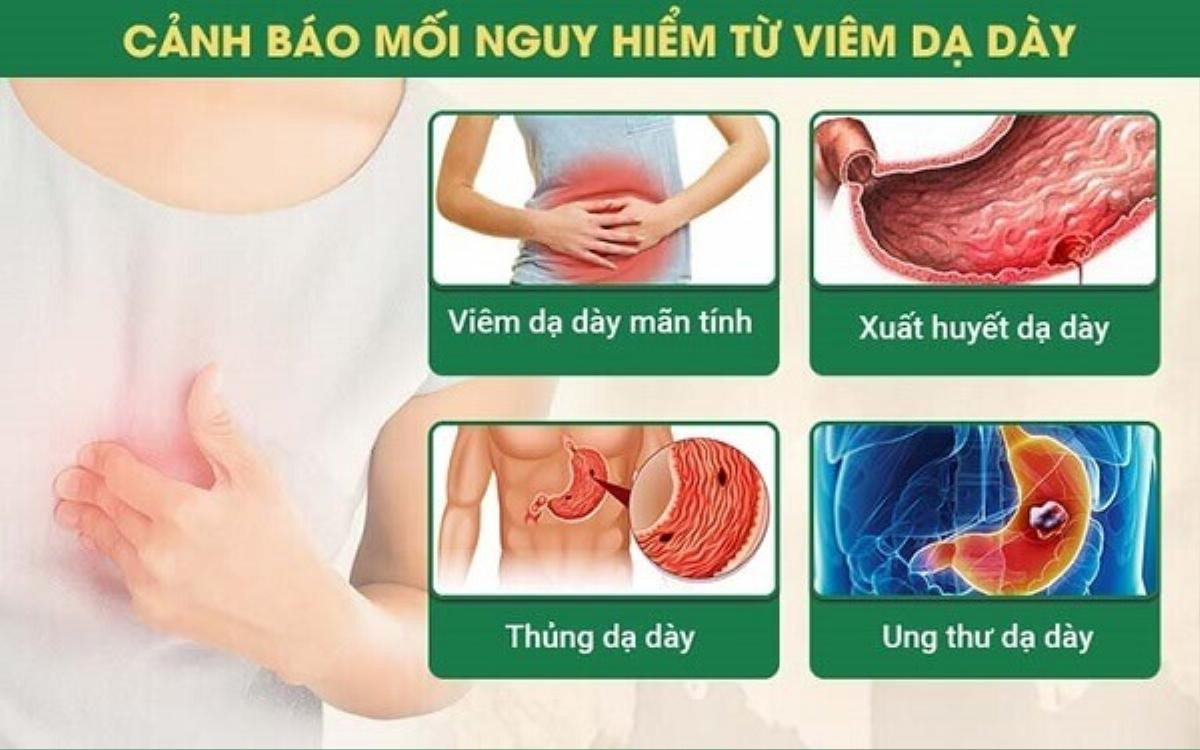 Những nhóm người nào có nguy cơ mắc ung thư dạ dày cao hơn? Ảnh 2