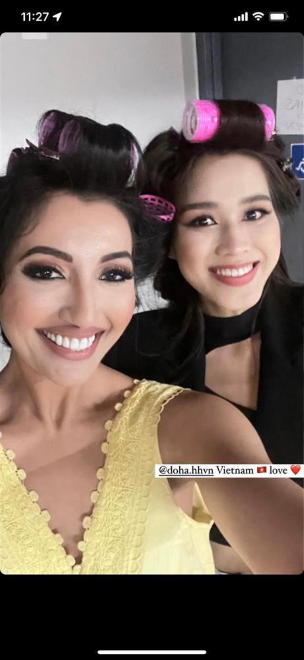 Á hậu Miss World 2021 từng bị bỏng mặt nặng, ngắm dung nhan hiện tại mà phải nể phục Ảnh 9