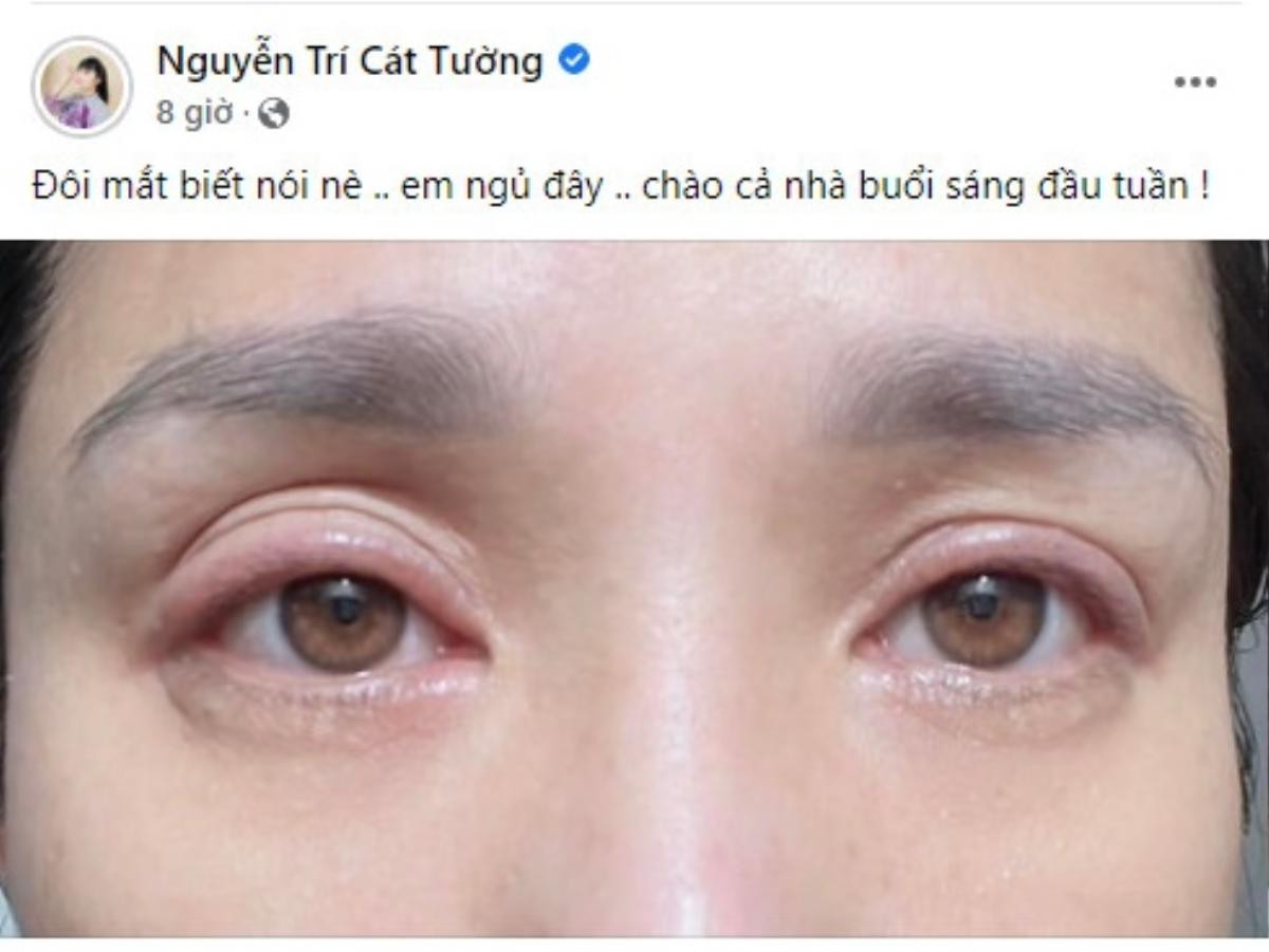 Cát Tường gây sốc khi xuất hiện với mí mắt sưng húp Ảnh 1