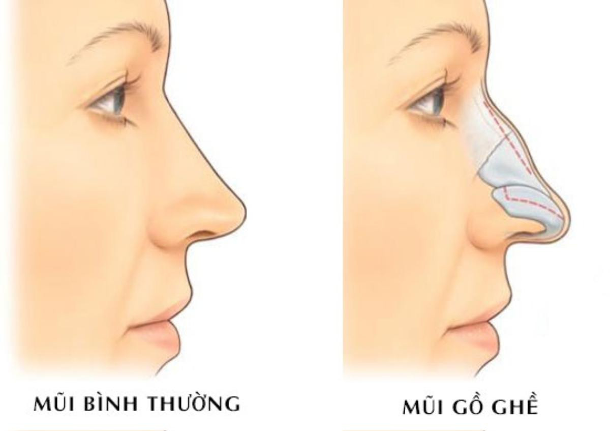 Những nét tướng của phụ nữ báo hiệu đường tình duyên lận đận trắc trở, khó tìm được bến đỗ bình yên Ảnh 5