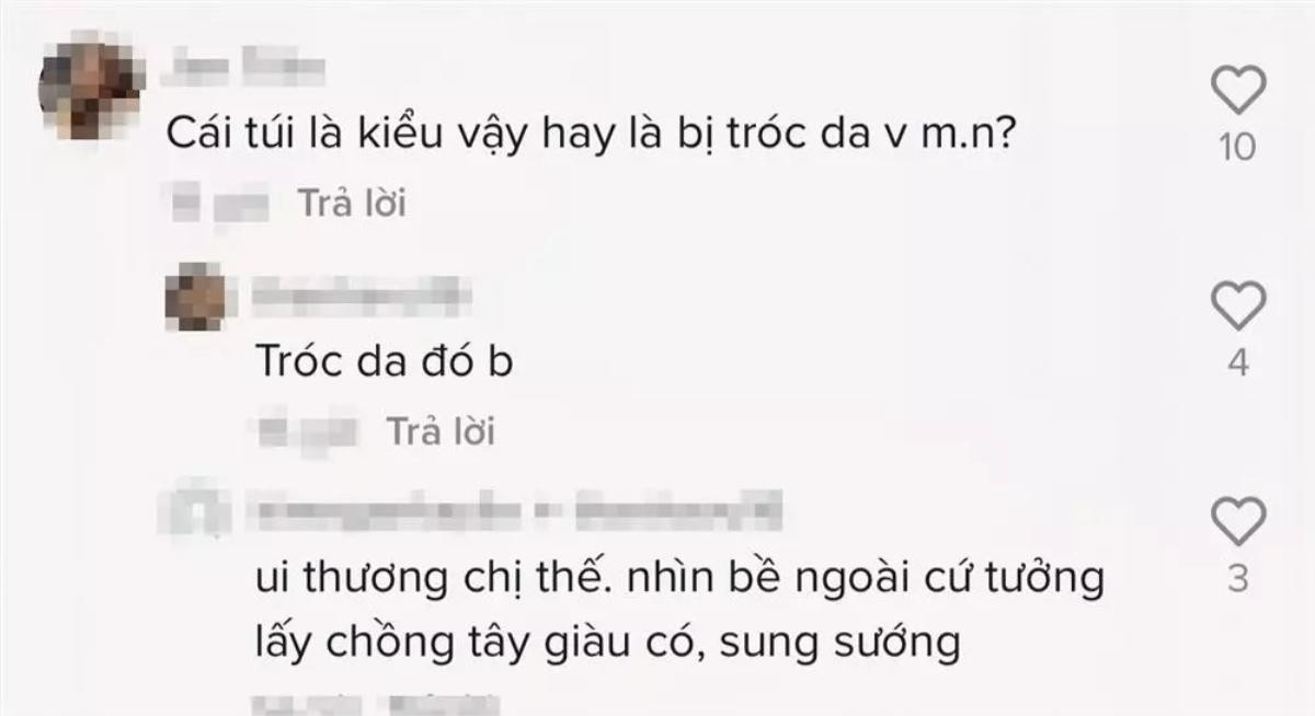 Hoàng Oanh bận chăm con nên dùng một món đồ đến nát bươm, nhìn mà xót xa Ảnh 5