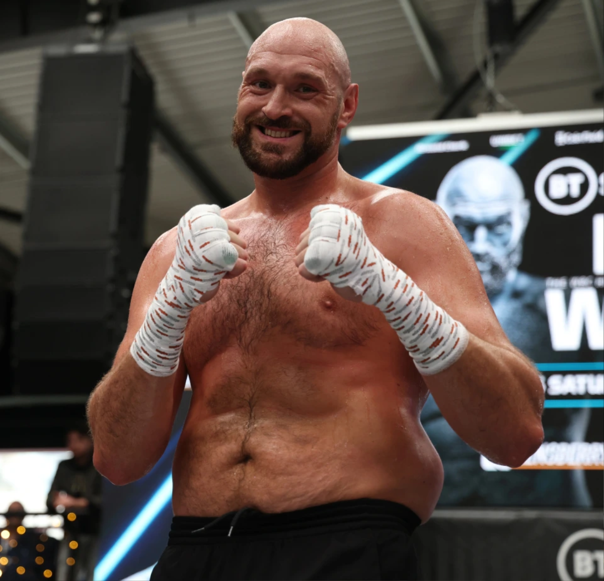 Em trai Tyson Fury: Dillian Whyte chỉ là tên to xác biết đấm nhau Ảnh 2