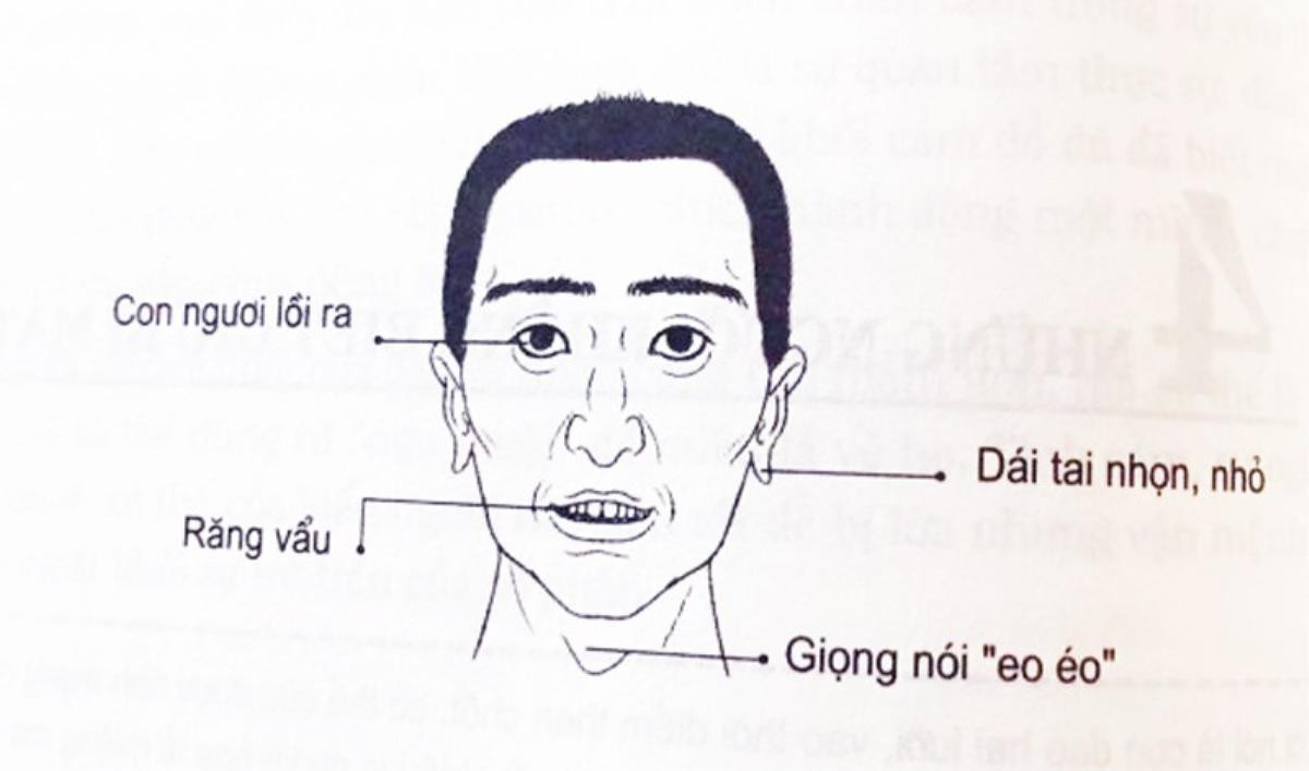 4 nét tướng đàn ông lắm điều nhiều chuyện, dễ gây thị phi khiến ai cũng không ưa Ảnh 1