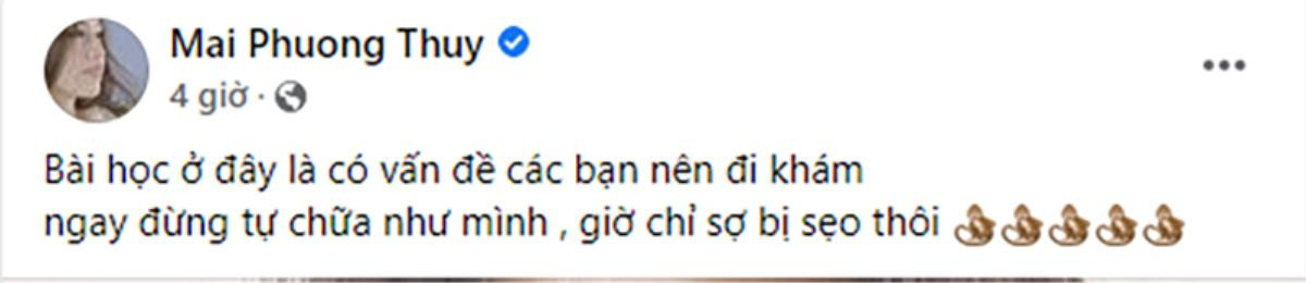 Hậu gây chú ý khi gọi Noo Phước Thịnh là chồng, Mai Phương Thúy đăng ảnh băng kín mắt gây xôn xao Ảnh 2