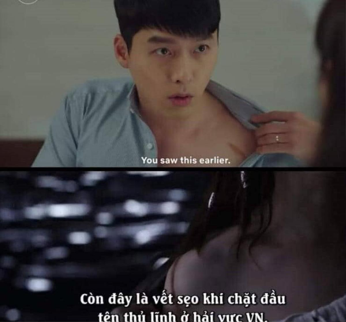 Hóa ra cảnh Hyun Bin cởi áo khoe sẹo được lấy cảm hứng từ chính Son Ye Jin Ảnh 1