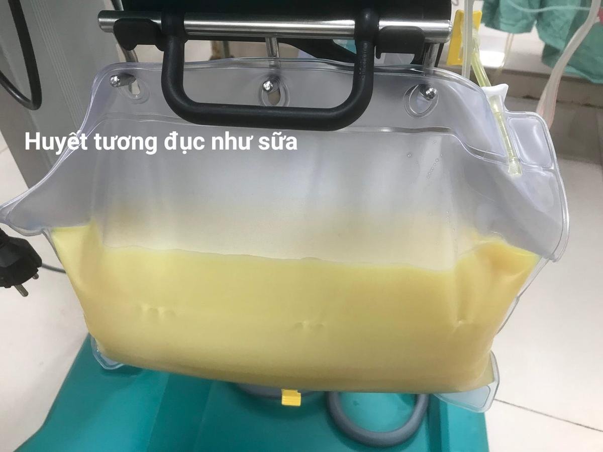 Bệnh nhân có huyết tương trắng đục như sữa được cứu sống Ảnh 2