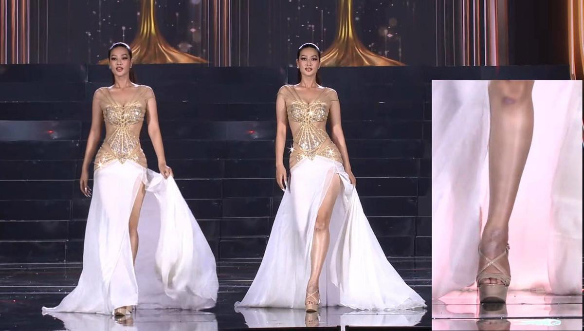 Top 10 Miss Grand Vietnam 2022 - Thiên Ân bất chấp vết thương chưa lành dự thi, netizen xót xa Ảnh 2