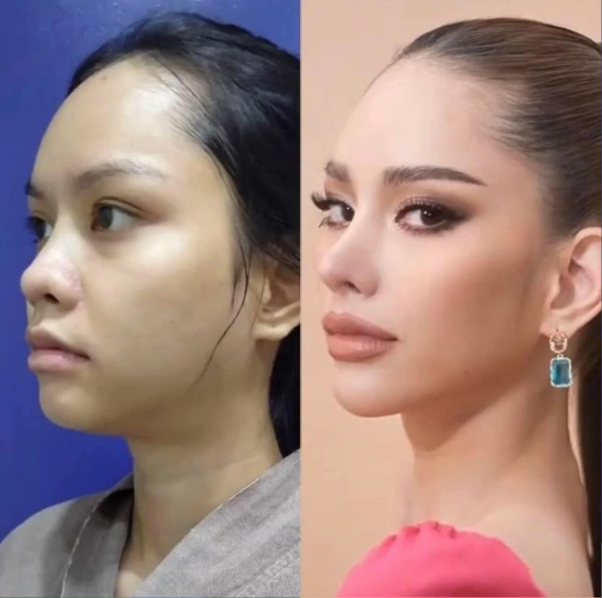 Bất ngờ trước nhan sắc 'chưa dao kéo' của đối thủ Ngọc Châu tại Miss Universe 2022: Đẹp thế mà vẫn sửa? Ảnh 3