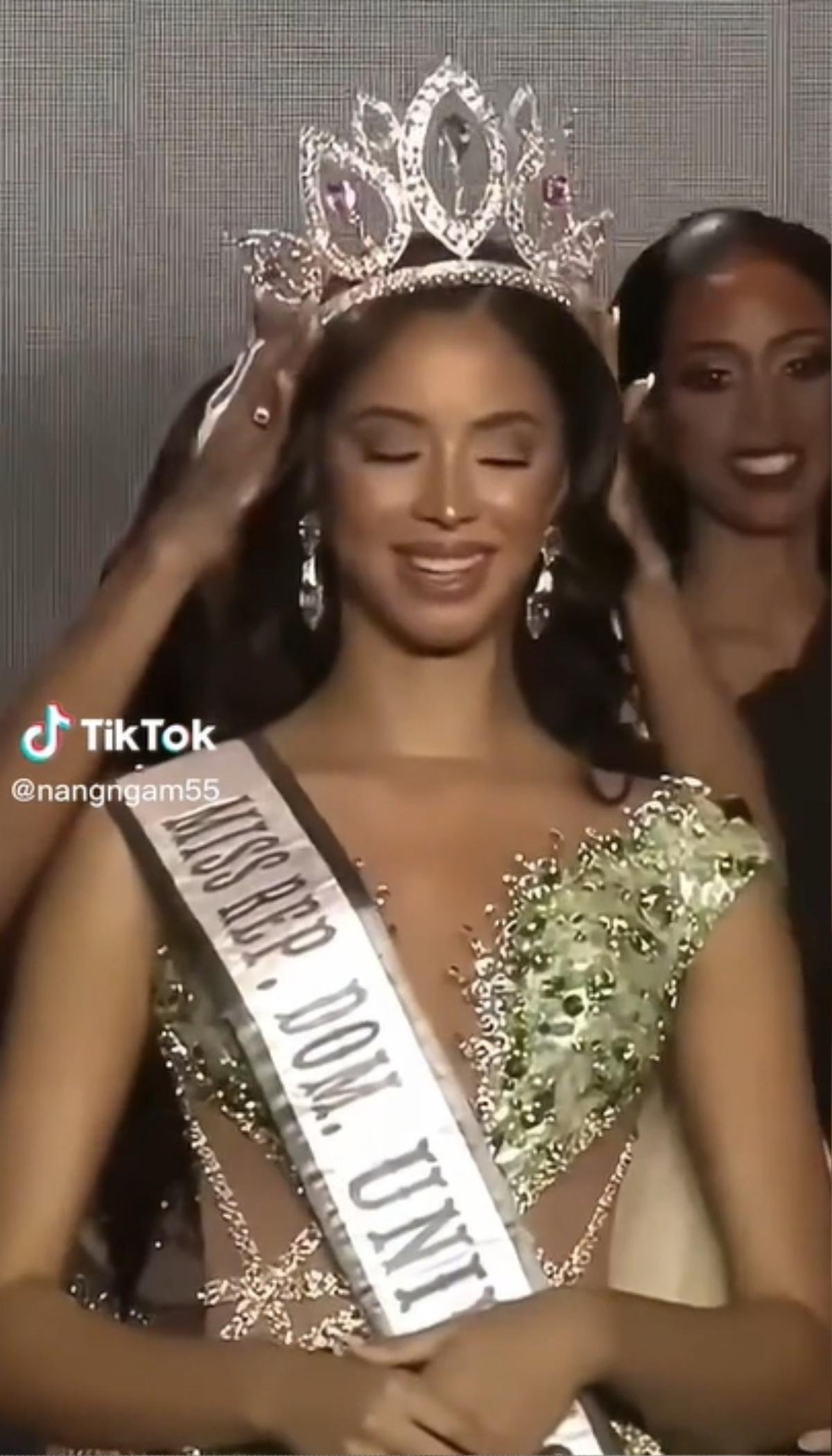 Rầm rộ clip Á hậu 2 Miss Universe 2022 đã độn cằm, gọt mặt, đăng quang ở quê nhà trông rất 'phèn' Ảnh 1